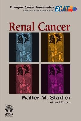 Renal Cancer(English, Hardcover, unknown)