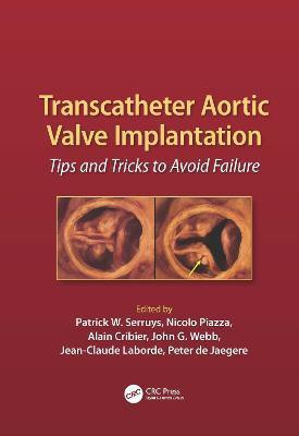 Transcatheter Aortic Valve Implantation(English, Hardcover, unknown)