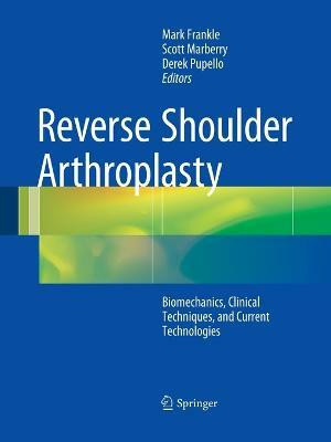Reverse Shoulder Arthroplasty(English, Paperback, unknown)