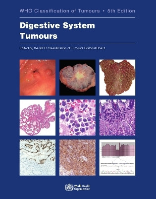 WHO Classification of Tumours. Digestive System Tumours(English, Paperback, unknown)