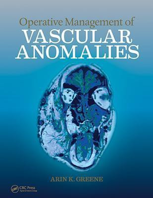 Operative Management of Vascular Anomalies(English, Mixed media product, unknown)