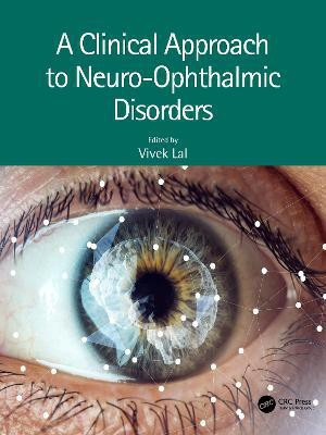A Clinical Approach to Neuro-Ophthalmic Disorders(English, Paperback, unknown)