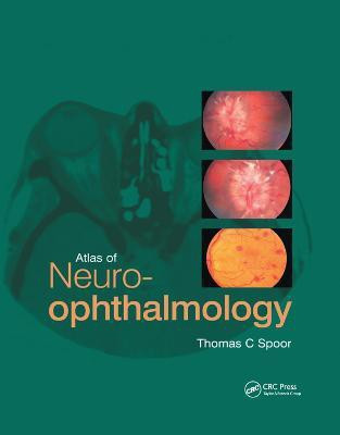 Atlas of Neuro-ophthalmology(English, Paperback, Spoor Thomas C.)
