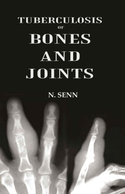 Tuberculosis of Bones and Joints [Hardcover](Hardcover, N. Senn)