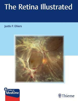 The Retina Illustrated  - THE RETINA ILLUSTRATED WITH ACCESS CODE (PB 2020)(English, Mixed media product, Ehlers Justis P.)