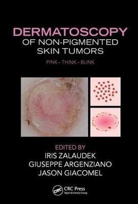 Dermatoscopy of Non-Pigmented Skin Tumors(English, Hardcover, unknown)