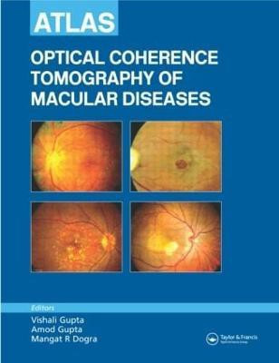 Atlas of Optical Coherence Tomography of Macular Diseases(English, Hardcover, Gupta Vishali)