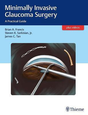 Minimally Invasive Glaucoma Surgery(English, Hardcover, Francis Brian)