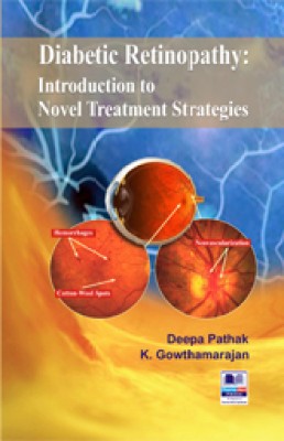 Diabetic Retinopathy: Introduction to Novel Treatment Strategies(Hardcover, Deepa Pathak)