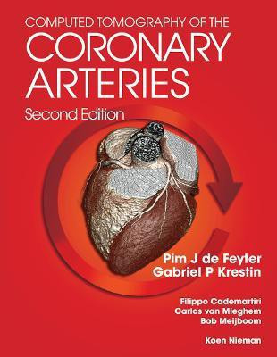 Computed Tomography of the Coronary Arteries(English, Paperback, unknown)