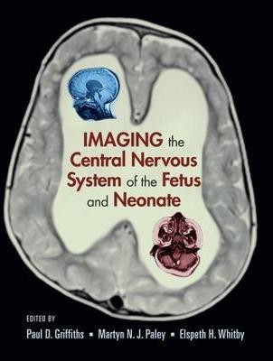 Imaging the Central Nervous System of the Fetus and Neonate(English, Electronic book text, unknown)