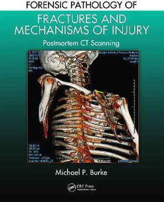 Forensic Pathology of Fractures and Mechanisms of Injury(English, Paperback, Burke Michael P.)
