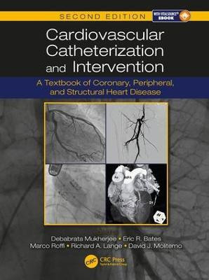 Cardiovascular Catheterization and Intervention(English, Hardcover, unknown)