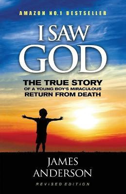 Revised Edition(English, Paperback, Anderson James Prof)