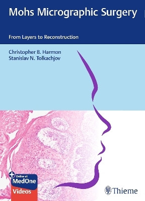 Mohs Micrographic Surgery: from Layers to Reconstruction(English, Mixed media product, Harmon Christopher B.)