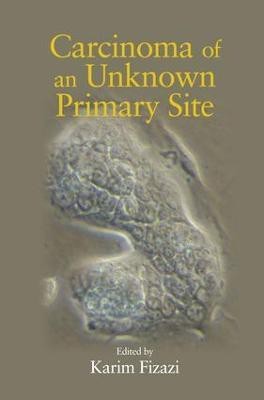 Carcinoma of an Unknown Primary Site(English, Electronic book text, unknown)