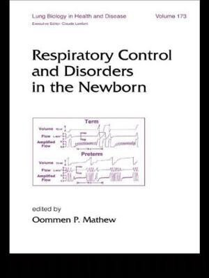 Respiratory Control and Disorders in the Newborn(English, Hardcover, unknown)