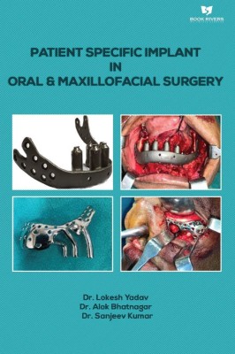 Patient Specific Implant In Oral & Maxillofacial Surgery(Paperback, Dr. Sanjeev Kumar,Dr. Alok Bhatnagar,Dr. Lokesh Yadav)