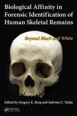 Biological Affinity in Forensic Identification of Human Skeletal Remains(English, Electronic book text, unknown)