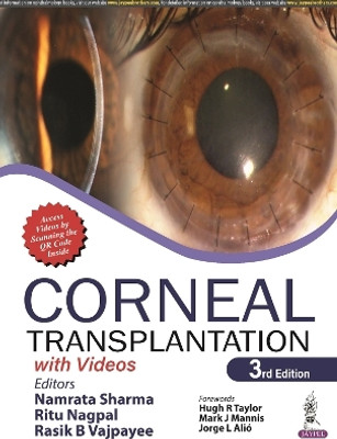 Corneal Transplantation(English, Paperback, Sharma Namrata)