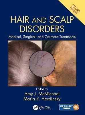 Hair and Scalp Disorders(English, Hardcover, unknown)