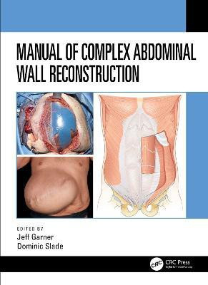 Manual of Complex Abdominal Wall Reconstruction(English, Paperback, unknown)
