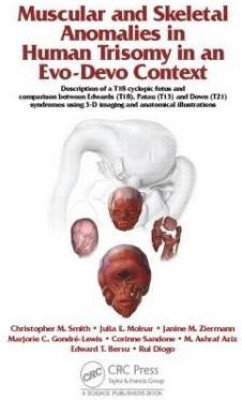 Muscular and Skeletal Anomalies in Human Trisomy in an Evo-Devo Context(English, Hardcover, Diogo Rui)