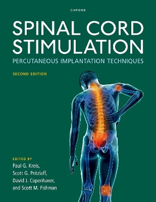 Spinal Cord Stimulation(English, Hardcover, unknown)