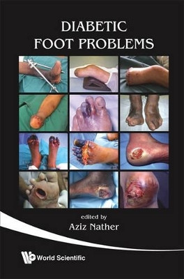 Diabetic Foot Problems(English, Paperback, unknown)