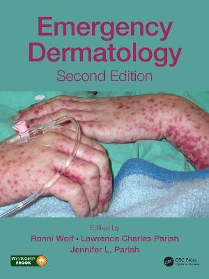 Emergency Dermatology(English, Electronic book text, unknown)