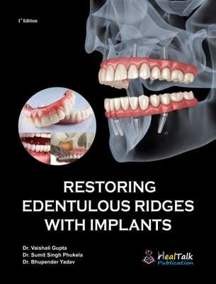 Restoring Edentulous Ridges With Implants(Paperback, Dr Vaishali Gupta, Dr Sumit Singh Phukela, Dr Bhupendar Yadav)
