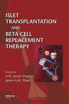 Islet Transplantation and Beta Cell Replacement Therapy(English, Electronic book text, unknown)