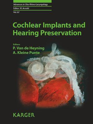 Cochlear Implants and Hearing Preservation(English, Electronic book text, unknown)
