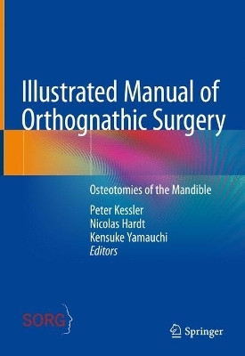 Illustrated Manual of Orthognathic Surgery(English, Hardcover, unknown)
