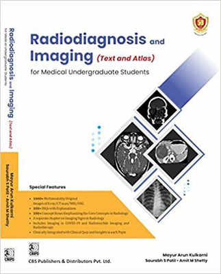 Radiodiagnosis and Imaging (Text and Atlas) for Medical Undergraduate Students ( PB -2022)(Paperback, Mayur Arun Kulkarni, Saurabh S Patil, Amit M Shetty)