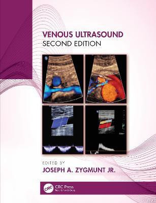 Venous Ultrasound(English, Electronic book text, unknown)