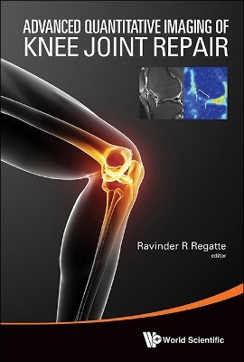 Advanced Quantitative Imaging Of Knee Joint Repair(English, Hardcover, unknown)