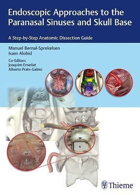 Endoscopic Approaches to the Paranasal Sinuses and Skull Base(English, Hardcover, unknown)