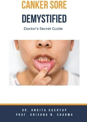 Canker Sore Demystified(English, Paperback, Kashyap Ankita Dr)