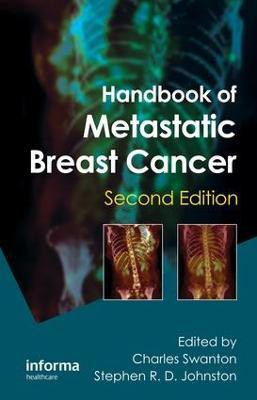 Handbook of Metastatic Breast Cancer(English, Electronic book text, unknown)
