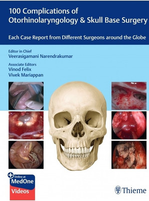 100 Complications of Otorhinolaryngology & Skull Base Surgery(English, Mixed media product, unknown)
