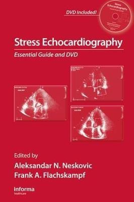 Stress Echocardiography(English, Electronic book text, unknown)