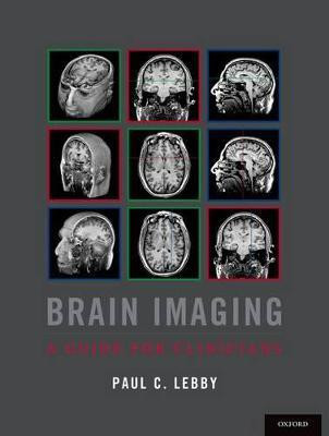 Brain Imaging(English, Paperback, Lebby Paul C.)