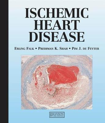 Ischemic Heart Disease(English, Electronic book text, Falk Erling)