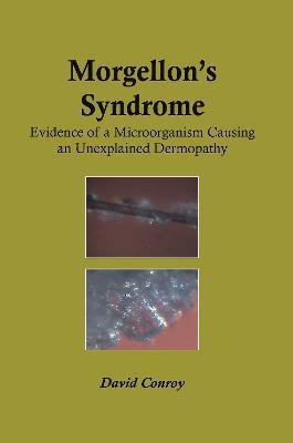 Morgellon's Syndrome(English, Electronic book text, Conroy David)