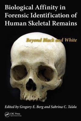 Biological Affinity in Forensic Identification of Human Skeletal Remains(English, Hardcover, unknown)