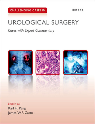 Challenging Cases in Urological Surgery(English, Paperback, unknown)