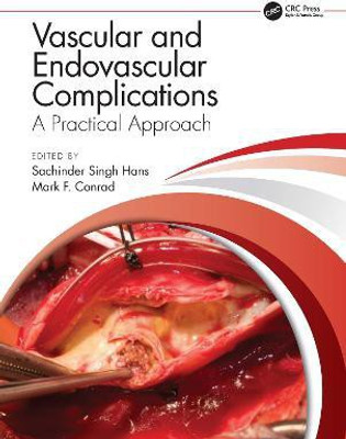 Vascular and Endovascular Complications: A Practical Approach(English, Hardcover, unknown)