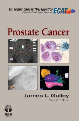 Prostate Cancer(English, Hardcover, unknown)