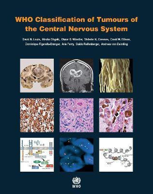 WHO classification of tumours of the central nervous system(English, Paperback, International Agency for Research on Cancer)